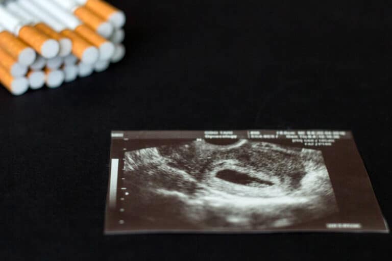 Une échographie montrant un embryon avec des cigarettes posées à côté.