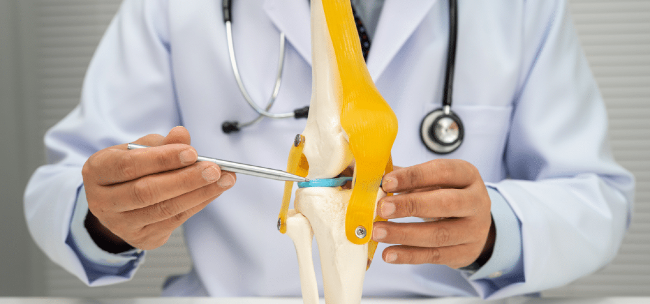 Médecin montrant comment l'arthrose affecte les articulations